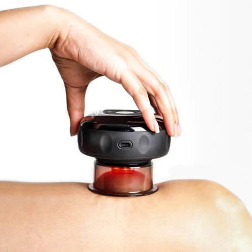 CuppingPro™ - Electric Cupping Therapy Massager